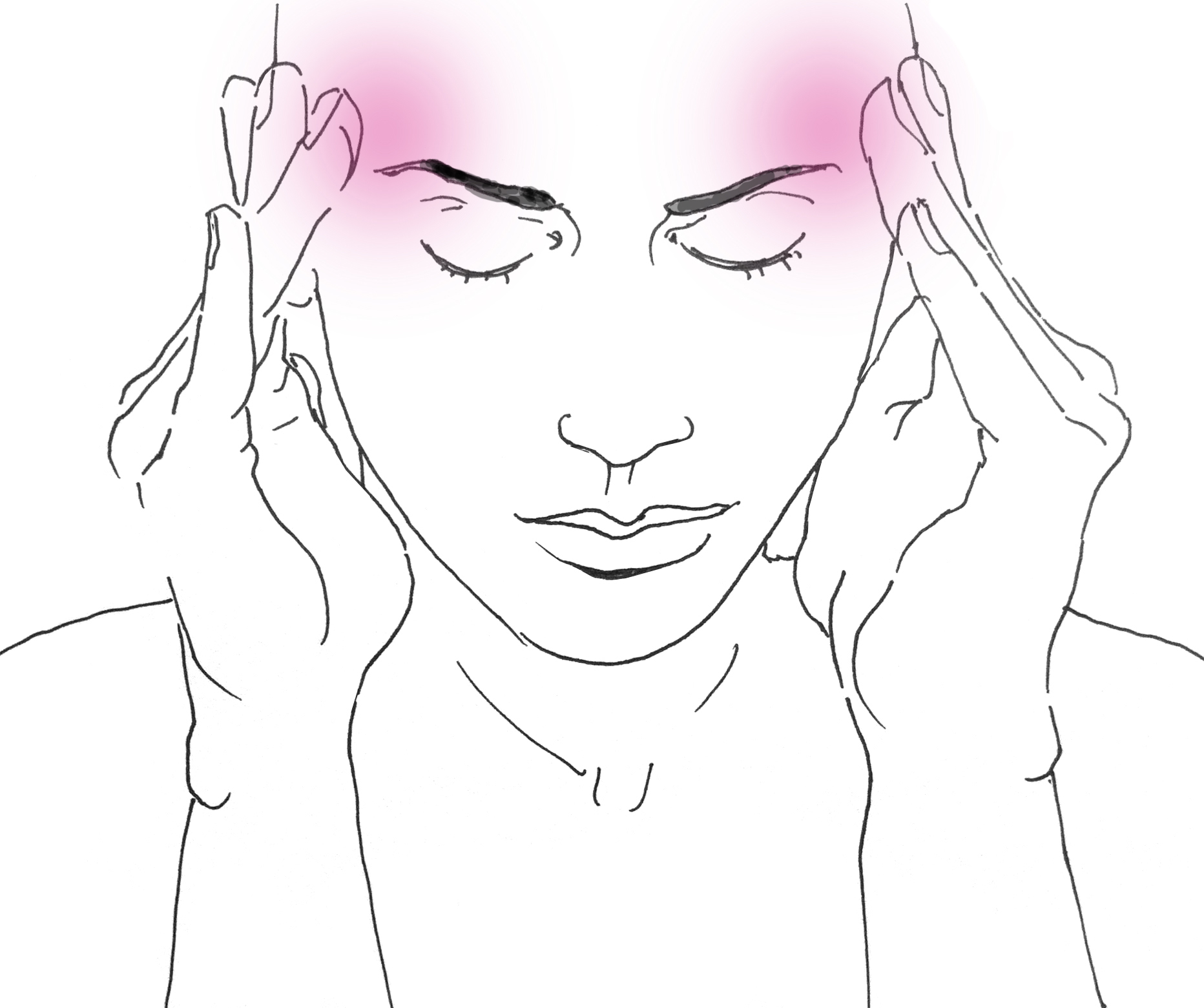migraine
